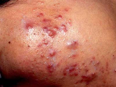 �ഺ�� �㳤������